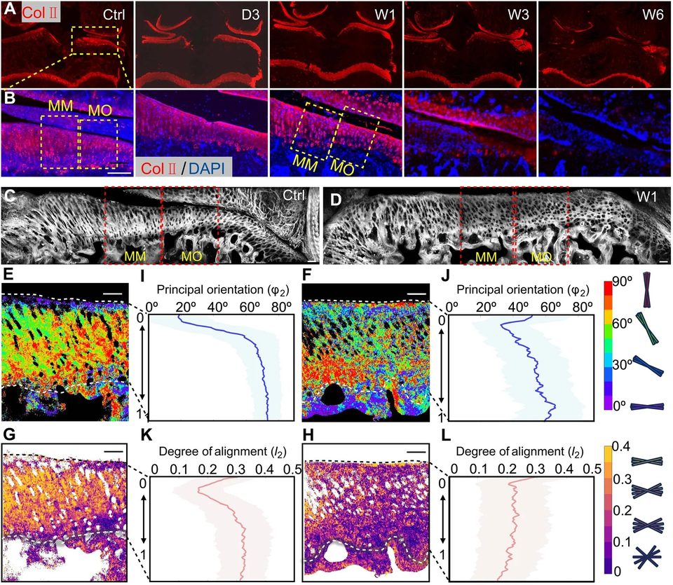 Ultrastructural changes in collagen fibril organization in the MM region of cartilage in intact (Ctrl) and W1 postsurgery cartilage. (A) Representative immunofluorescence staining for type II collagen (Col II) in cartilage sections at different stages of OA progression (intact to W6 postsurgery). (B) Magnified Col II and DAPI images, showing detailed Col II changes in the cartilage matrix during OA progression (scale bar, 200 um). (C and D) Representative overview images of collagen in medial cartilage obtained by summing SHG signal across all polarization angles. (E and F) Pixel-based heat maps showing the principal orientation of collagen fibrils in MM regions, with representative examples from the Ctrl and W1 groups (n = 3). Colors closer to purple indicate fibrils more parallel to the cartilage surface, whereas colors closer to red indicate fibrils more perpendicular to the cartilage surface. (G and H) Heatmaps depicting the degree of alignment of collagen fibrils in MM regions, corresponding to those in (E) and (F). Brighter colors indicate higher fibril alignment (scale bars, 50 um). (I and J) Depth-dependent line plots of (E) and (F), showing the mean principal orientation of collagen fibrils (blue lines) within each row and their heterogeneity (light blue shading) across cartilage depth, normalized from articular surface to cement line. (K and L) Corresponding depth-dependent line plots for (G) and (H), showing the row mean values of collagen fibril alignment (red lines) and the heterogeneity within each row (light red shading), normalized from cartilage surface to cement line. D3, 3 days; W1, 1 week; W3, 3 weeks; W6, 6 weeks.
