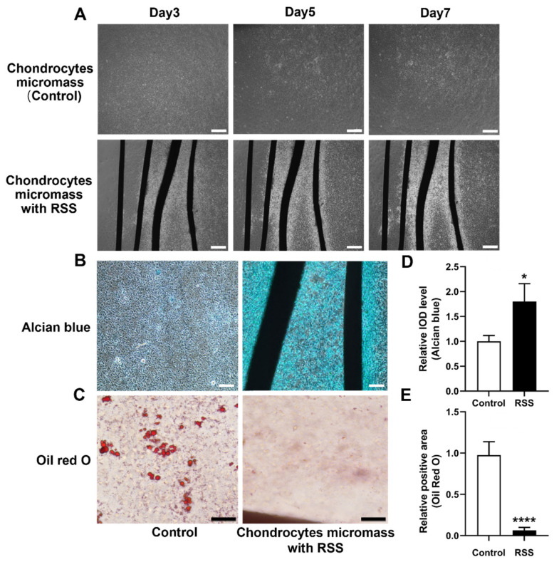 RSS enhances chondrocyte aggregation and chondrogenesis while suppressing adipogenesis. (A) Phase-contrast images of micromass cultures with and without RSS treatment. Scale bar: 400 um. (B) Representative images of Alcian blue staining indicating glycosaminoglycan deposition in micromass cultures with and without RSS. Scale bar: 200 um. (C) Representative images of Oil Red O staining showing lipid droplet formation in micromass cultures with and without RSS. Scale bar: 50 um. (D) Quantitative analysis of integrated optical density (IOD) for Alcian blue staining. * p < 0.05, n = 3. (E) Quantification of Oil Red O-positive area. **** p < 0.0001, n = 3.