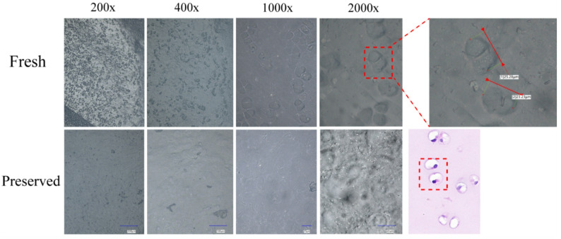 UDFM the cellular status was observed at varying degrees of freshness. In the fresh group, intact cellular structures were clearly visible, closely resembling those seen in histological staining. The diameter of the chondrocyte lacunae was measured to be 25.28 um and 23.23 um. In contrast, cartilage tissue preserved for more than one day rarely exhibited intact cellular structures.